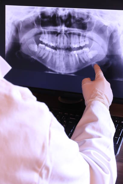Best Same-Day Emergency Dentist in Divernon, IL